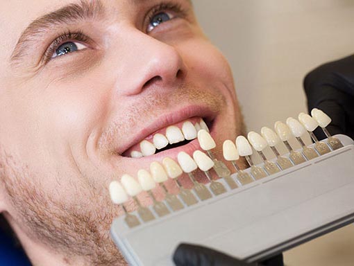 Porcelain Veneers in %91digicity%93