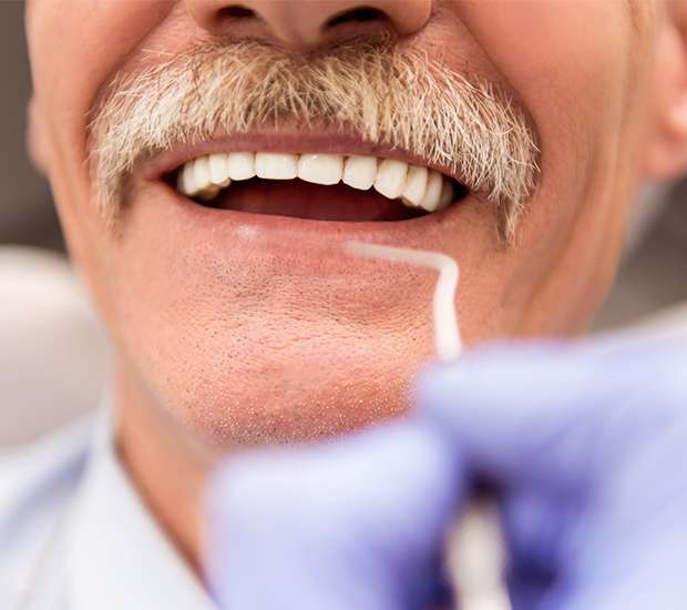 Palatine Adjusting to New Dentures