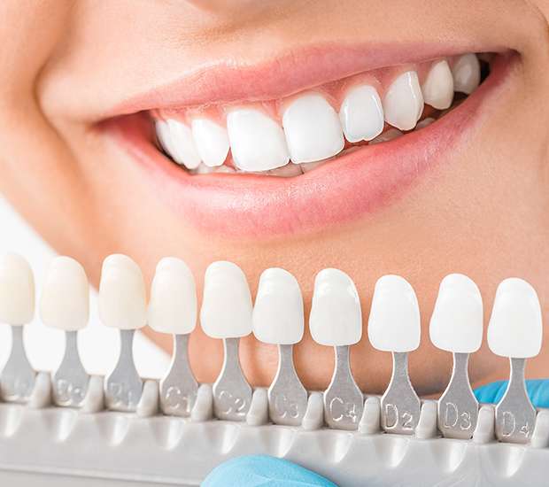 Palatine Cosmetic Dentist