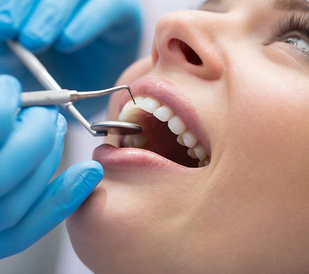 Palatine Dental Bonding