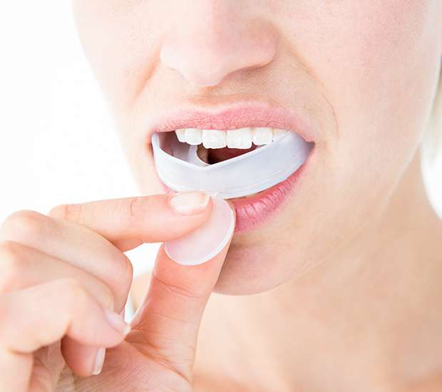 Palatine Mouth Guards