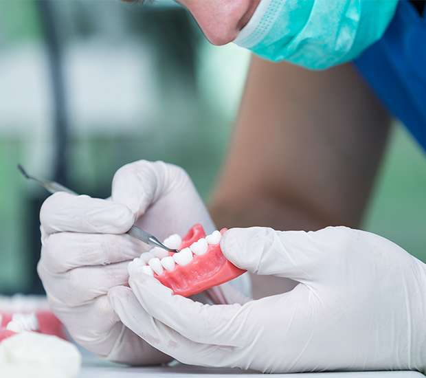 Palatine Partial Dentures for Back Teeth
