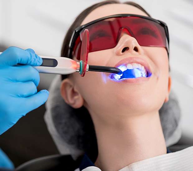 Palatine Professional Teeth Whitening