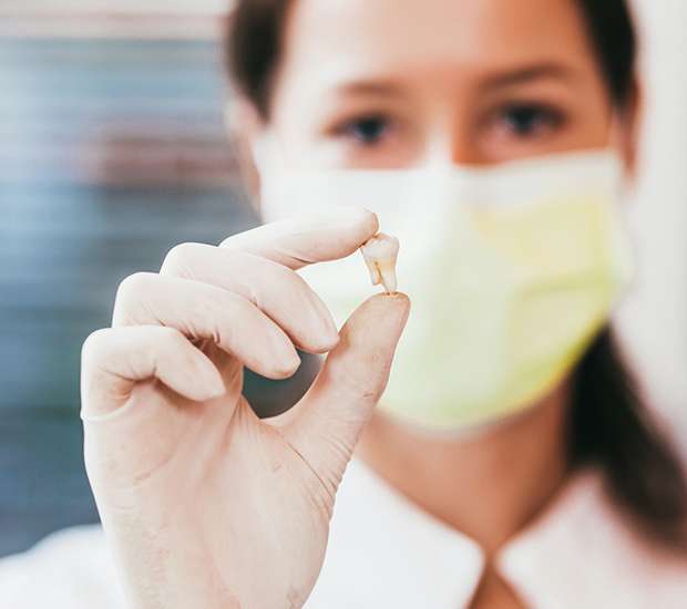 Palatine Tooth Extraction