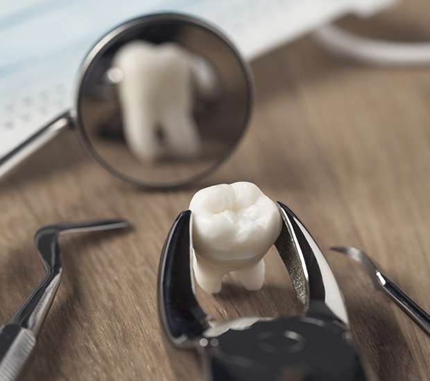 Palatine When Is a Tooth Extraction Necessary